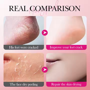 <span class=keywords><strong>Meilleure</strong></span> vente SADOER Hydratant Protection Hydratant Squalane Pêche Stick Anti Fissuration Baume 4-en-1 Soins de la peau <span class=keywords><strong>Crème</strong></span> pour les <span class=keywords><strong>pieds</strong></span> - Product Image 5