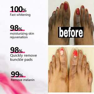 Sérum <span class=keywords><strong>pour</strong></span> peaux à tendance acnéique, essence faciale, sérum <span class=keywords><strong>pour</strong></span> peaux à tendance acnéique, éclaircissant <span class=keywords><strong>pour</strong></span> <span class=keywords><strong>le</strong></span> <span class=keywords><strong>visage</strong></span>, réparateur, éliminateur de <span class=keywords><strong>boutons</strong></span>, cosmétique, vente en gros en usine - Product Image 3