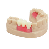Resin Cetak Gigi 3D Mudah Dicetak Warna Hijau Kemurnian 99% untuk Printer 3D DLP LCD SLA Penyusutan Rendah Pengerasan UV 2-12 detik