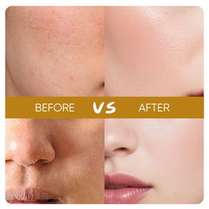 Sérum visage hydratant et anti-âge à l'essence de pulpe de riz naturelle pure, marque privée OEM. - Product Image 3