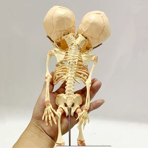 Modèle de squelette humain de bébé, squelette fœtal à deux têtes, déformité du squelette du nourrisson, décoration d'Halloween - Product Image 3