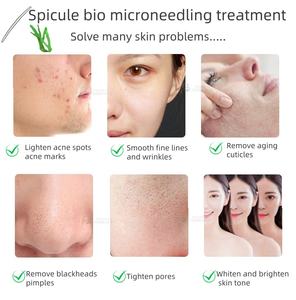 OEM Spongilla algas peeling polvo piel renovación Peeling sistema para estética cosmetología <span class=keywords><strong>Academia</strong></span> - Product Image 6