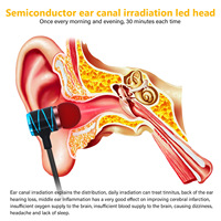 Masseur sans fil pour le conduit auditif, Irradiateur auriculaire rechargeable, Réduit les acouphènes, Appareil de thérapie par lumière rouge 650NM pour les soins des oreilles