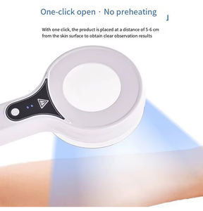 Lámpara de madera portátil Resultados de observación claros Luz de diagnóstico de la piel para vitiligo y <span class=keywords><strong>psoriasis</strong></span> No se necesitan gafas Analizador de piel - Product Image 5
