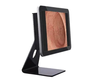 Système de caméra endoscopique pour Endoscope médical