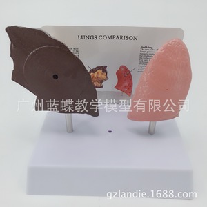 Modelo de pulmón, molde de la estructura pulmonar, riesgos para la salud por el tabaquismo, sistema respiratorio pulmonar del fumador, modelo anatómico patológico del pulmón - Product Image 5