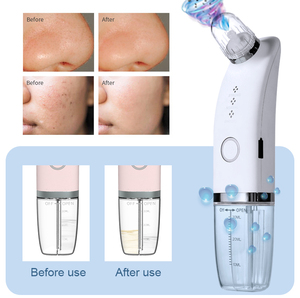 Máquina de Succión Manual Mini ABS Avanzada <span class=keywords><strong>Taibo</strong></span> para Eliminar Puntos Negros, Tiras Nasales Faciales, Uso Doméstico, Múltiples Enchufes - Product Image 5