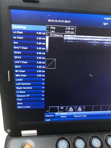 <span class=keywords><strong>2025</strong></span> nouvelle mise à niveau 3D Vet utiliser Diagnostic Echo ordinateur portable numérique couleur Doppler <span class=keywords><strong>Machine</strong></span> SUN-906A