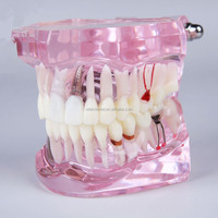 [AiFan Dental], producto en oferta, 2001, implante, modelo de estudio dental tipodont