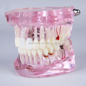 Máy Cấy Ghép Nha Khoa AiFan, Mô Hình Nghiên Cứu Nha Khoa Cấy Ghép 2001 Giảm Giá Mạnh - Product Image 4