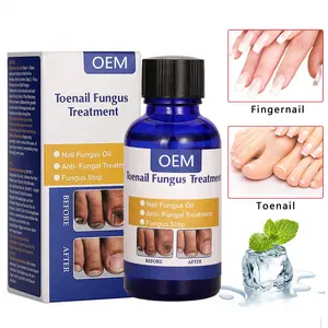 Oem Natuurlijke Nail Behandeling Olie, Effectief Tegen Nail Infectie Schimmel Nagel Behandeling Beschadigd