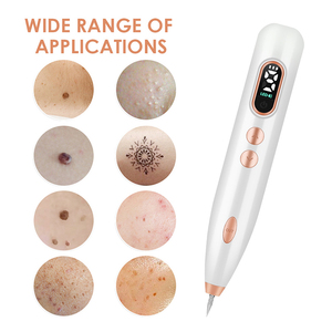 Newest Freckle Warts Dot Mole Tattoo Removal Pen Electric Skin Tag Remover Pen for Household Use Portable Facial Spot Remove - Product Image 4