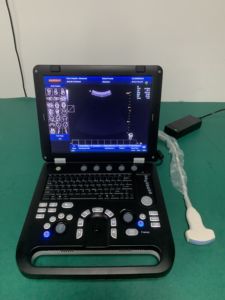Ecógrafo Doppler Color Portátil para Uso Humano, Ginecología y Cardiovascular SUN-906A - Product Image 3