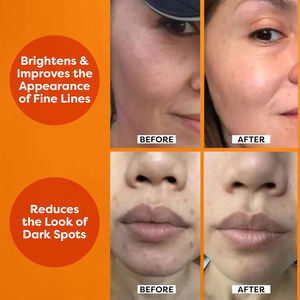 Sérum hydratant illuminateur Radiant Glow avec 30 ml d'hydratation, propriétés anti-rides et anti-âge, vitamine C liquide pour le visage - Product Image 2