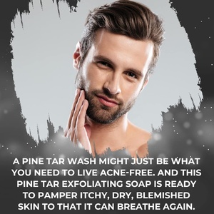 Barre de <span class=keywords><strong>savon</strong></span> au goudron de pin naturel nettoyant <span class=keywords><strong>Anti</strong></span> acné eczéma Psoriasis charbon de bois huile essentielle pour le visage et le corps bain <span class=keywords><strong>savon</strong></span> noir fait à la main - Product Image 2