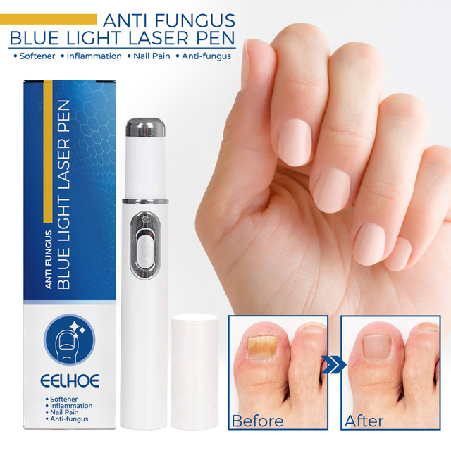 Wholesale Painless Nail Pain Relief Anti Fungus Blue Light Laser Pen