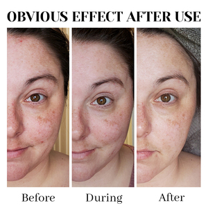 Sérum de <span class=keywords><strong>visage</strong></span> à la racine de réglisse de marque privée Sérum éclaircissant pour la peau Élimination des taches noires Sérum blanchissant pour le <span class=keywords><strong>visage</strong></span> - Product Image 6