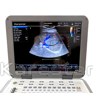 Échographe Doppler Couleur Numérique Complet avec Batterie – Promotion Spéciale – Appareil d'Échographie Vétérinaire Portable - Product Image 4