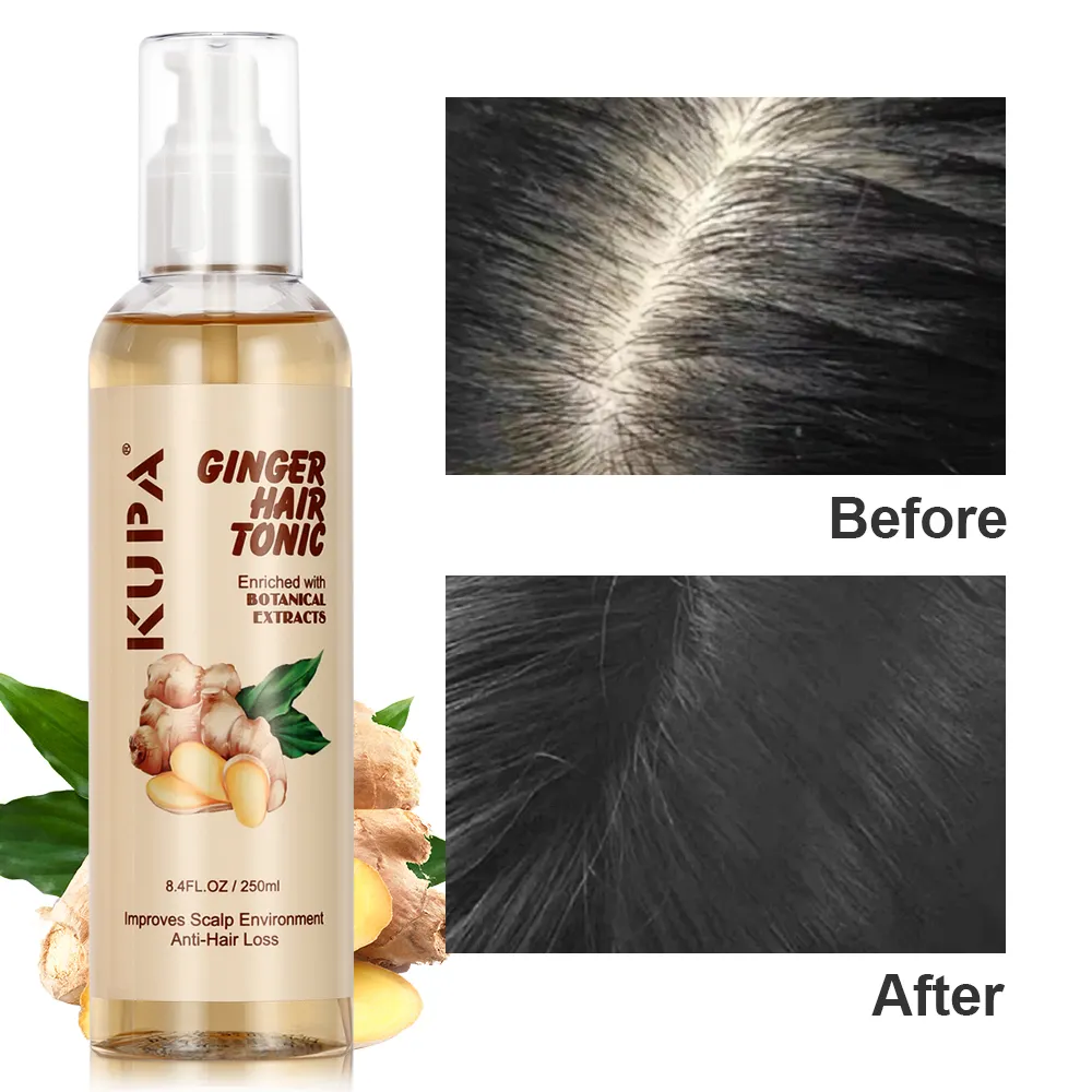 KUPA Tratamento de cuidados com os cabelos com ginger natural, produto de venda quente, estimula os folículos capilares, promove o crescimento dos cabelos, tônico