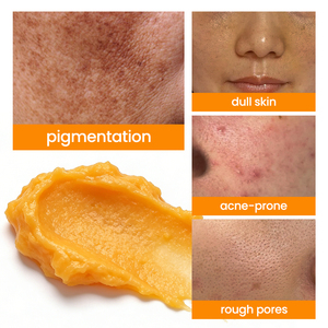 Jabón Molato Original del Fabricante, Cuidado Facial, Aclarante, Elimina <span class=keywords><strong>Manchas</strong></span> Oscuras, Iluminador, Limpiador - Product Image 5