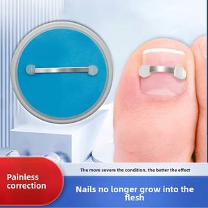 Dispositif de correction des ongles avec fragment osseux bionique en alliage nickel-titane et ensemble de fils d'acier - Style universel <span class=keywords><strong>pour</strong></span> les ongles incarnés - Product Image 2