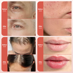 Zoek Mooie Micro-Infusie Hydra Pen Derma Microneedling Pen <span class=keywords><strong>Ems</strong></span> Face Lifting <span class=keywords><strong>Massager</strong></span> Met Vloeistof Dragen Voor Huidverzorging - Product Image 6