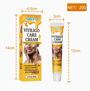 Ungüento para Eliminar Efectivamente el Vitiligo, Elimina la Tiña y las Manchas Blancas, Producto para el Cuidado de la Piel con Vitiligo - Product Image 5