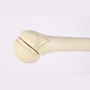 Kyrenmed cortical <span class=keywords><strong>humerus</strong></span> ขวา fractureed กับ <span class=keywords><strong>proximal</strong></span> <span class=keywords><strong>humerus</strong></span> <span class=keywords><strong>fracture</strong></span> สำหรับการประชุมเชิงปฏิบัติการการตัดเจาะ - Product Image 4