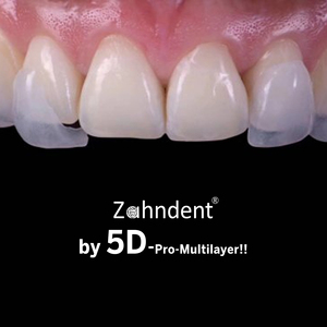 Zahndent mới phổ biến 57% mờ CAD cam phòng thí nghiệm Nha Khoa Vật liệu nha khoa 5D Pro Multilayer Zirconia khối - Product Image 6