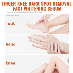 Novo Sérum Removedor de Manchas Escuras 2025 para Mãos, Pés e Joelhos, Sérum Clareador com Niacinamida, Remove Pigmentação de Tornozelos Negros - Product Image 3