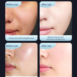 Appareil de beauté hydro-nécessaire professionnel non invasif, petit format, avec bouteille suspendue, Flash Water Light <span class=keywords><strong>Pro</strong></span> pour salon et usage domestique - Product Image 6