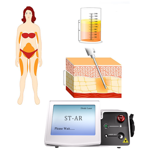 Máquina de Endoláser F-D-A para Rejuvenecimiento Facial, Láser de 650nm, 980nm y 1470nm, Máquina de Lipólisis Láser, Liposucción y Endolifting - Product Image 1