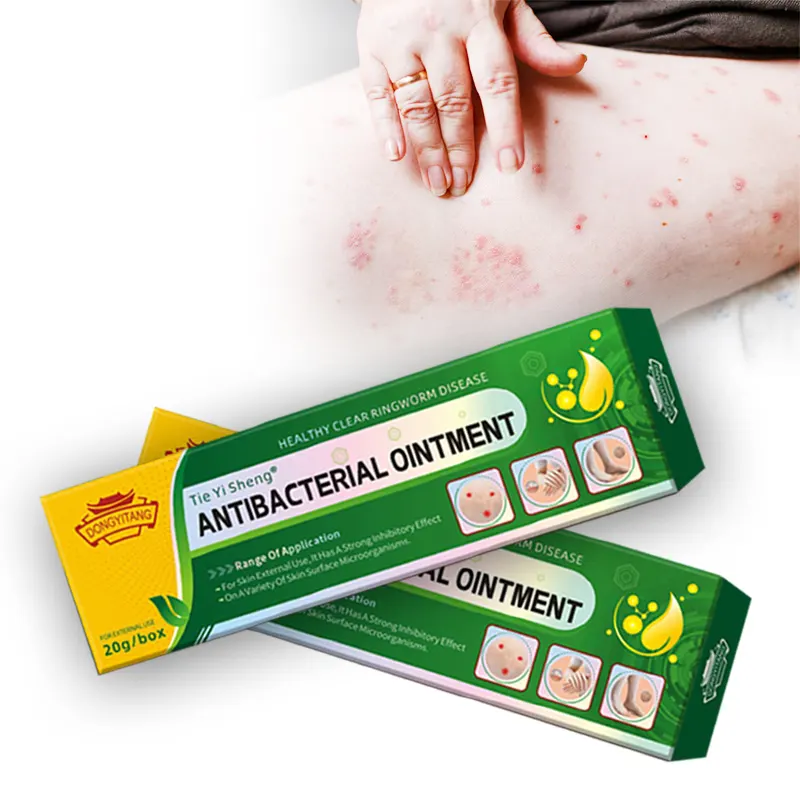 Factory Supply Skin Anti Itching Psorlasis Eczema Treatment Ointment