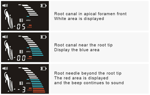 Endodónticos Root Canal Vdw Raypex 5 mejores pantalla táctil ápice Dental localizador con CE ISO - Product Image 4