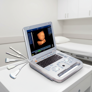 Échographe Doppler Couleur Numérique Obstétrical sur Chariot, Machine de Diagnostic Sans Fil - Product Image 1
