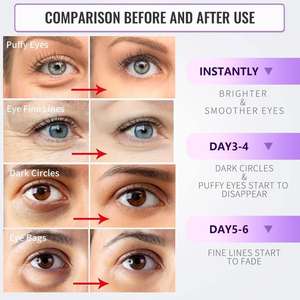 Parches Veganos para Ojos Heopif, 6 Pares, Mascarilla de Gel con Ácido Hialurónico para Ojos Hinchados y Ojeras - Product Image 5