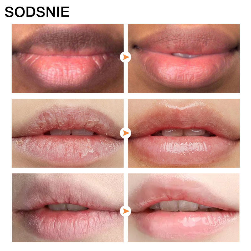 can vitamin c lighten lips Buy Ceramide & Vitamin C Lightening Lip Balm with SPF 30 PA++