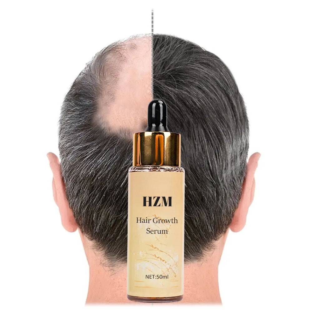 OEM/ODM 100% Natural Organic Nourishing Scalp Man Women Loss Treatment Hair Growth Oil Serum