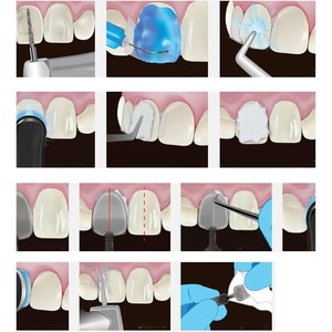 32pcs Dental Veneers <b>Mould</b> Set Different Shapes Heat Resistance Front Back <b>Teeth</b> Composite Resin Mold Commercial Use Convenient - Product Image 5