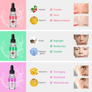 Cosméticos Etiqueta Privada Cuidado DE LA PIEL Blanqueamiento facial Arbutina Suero de ácido hialurónico <span class=keywords><strong>Caracol</strong></span> natural Mucina Vitamina C Juego de suero de retinol - Product Image 2