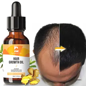 Private Label Best Hair Regrowth Oil Anti Hair loss Treatment Organic Ginger Hair Growth Oil Serum For Men Woman