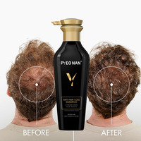 Lotion Capillaire Bio Naturelle pour la Croissance des Racines, Contre la Chute et les Dommages, Stimule la Densité, Amino Pro-Kératine, Gingembre Anti-Pelliculaire