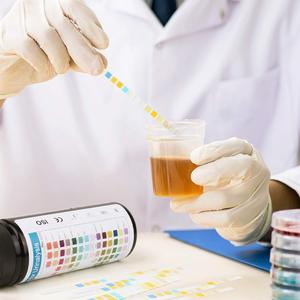 Strisce Reattive 14-URS per Analisi delle Urine e Rilevamento di ITU, <span class=keywords><strong>LEK</strong></span>, Pro, Ket e Altro, Test Completo - per Uomini e Donne - Product Image 5