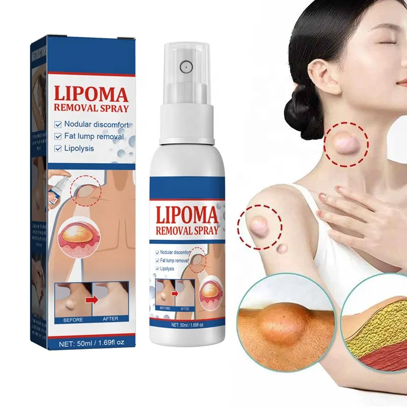 Sản Phẩm Thịnh Hành 2023 Hàng Mới Về Sản Phẩm Chăm Sóc Da Xịt Loại Bỏ Lipoma