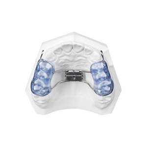 <span class=keywords><strong>Appareil</strong></span> d'expansion <span class=keywords><strong>dentaire</strong></span> amovible de classe II, plaque orthodontique en acrylique pour le redressement des dents, personnalisation - Product Image 4