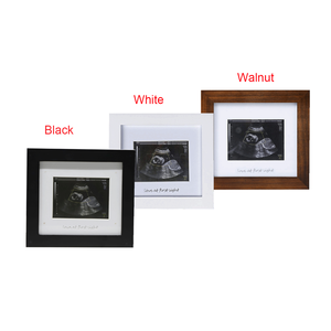 Vente directe d'usine montre personnalisée B-échographie photos bébé sonogramme cadre photo moderne cadre à ultrasons pour maman - Product Image 3