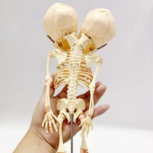 Foetale Twee Koppige Misvorming Model Schedel Medische Wetenschap Baby Skeletmodel Leert Menselijk Botmodel Abnormaal - Product Image 4