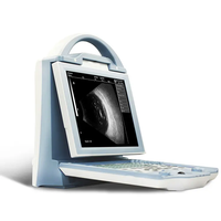 Échographe ophtalmique portable ODU 5 entièrement numérique A/B, haute résolution, économique, prix compétitif, pour usage vétérinaire