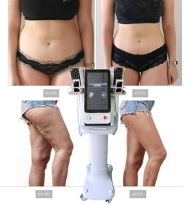 GRAN OFERTA 2026: Máquina para Perder Peso sin Dolor, Reduce la Grasa sin Cirugía, Económica y Efectiva, Disminuye el IMC - Product Image 4