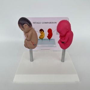 Comparaison des sciences médicales Modèle de maladie de pathologie de malformation fœtale humaine Modèle de maladie d'organe Modèle anti-drogue - Product Image 5